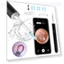 Smart Visual Ear Cleaner with HD Camera and WiFi — Blackhead & Blemish Removers, SUNUO