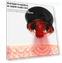 Превью Intelligent Head and Eye Massager — Back Relief Solutions, Yesido