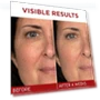 थंबनेल Revitalift Triple Power Anti-Aging Face Moisturizer — Beauty & Personal Care, L'OREAL PARIS