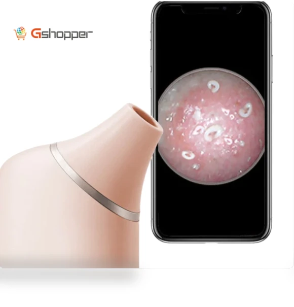 AI Visual Blackhead Remover Camera — Blackhead & Blemish Removers