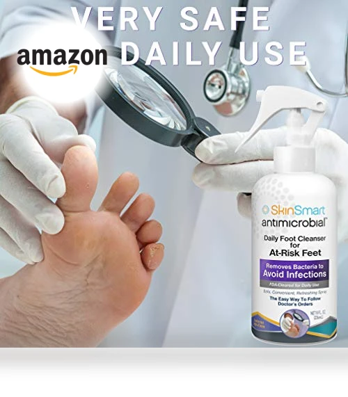 Daily Foot Cleanser Spray for At-Risk Feet, 8 ounce — Hand Wash, SkinSmart
