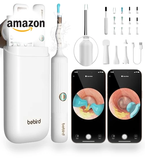 Earsight Plus Ear Wax Removal Tool Camera — Wax Removal, BEBIRD