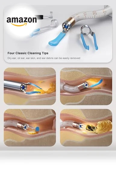 Earsight Plus Ear Wax Removal Tool Camera — Wax Removal, BEBIRD