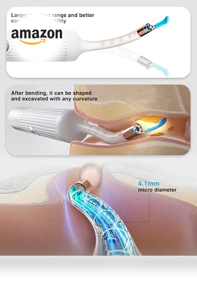Earsight Plus Ear Wax Removal Tool Camera — Wax Removal, BEBIRD
