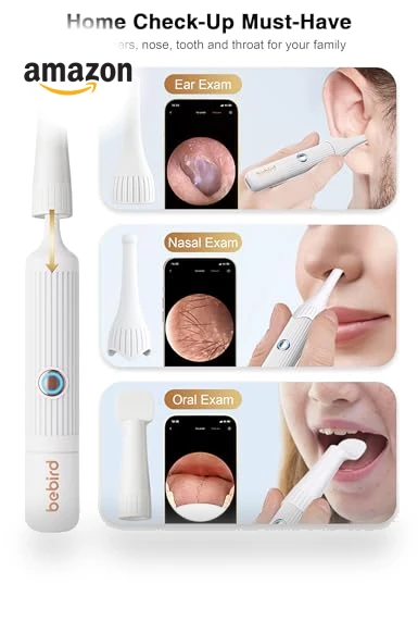 Earsight Plus Ear Wax Removal Tool Camera — Wax Removal, BEBIRD