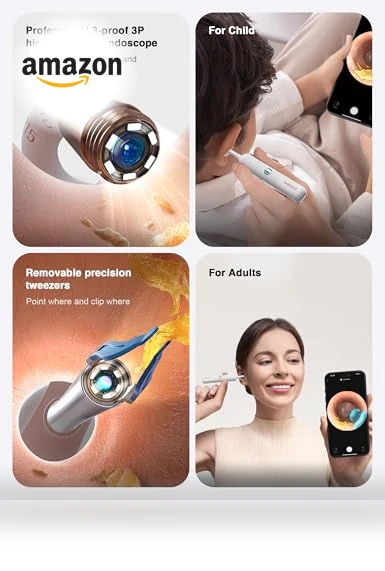 Earsight Plus Ear Wax Removal Tool Camera — Wax Removal, BEBIRD