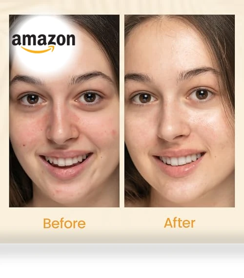 Gel Moisturizer for Face — Creams & Moisturizers, Honeyskin