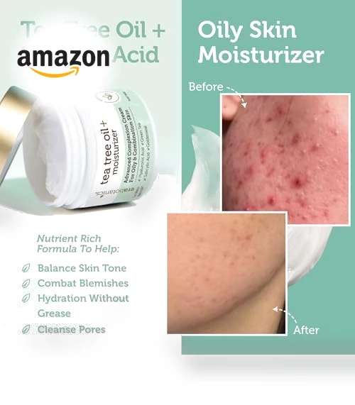 Tea Tree Cream Face Moisturizer for Oily Skin — Beauty & Personal Care, Era Organics