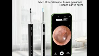 Smart Acne Squeezing Cleaner otoscope @model X8