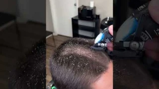 BARBER CUTS OFF LICE!!!! MUST WATCH