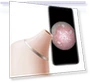 Thumbnail AI Visual Blackhead Remover Camera — Blackhead & Blemish Removers