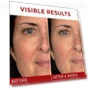 Превью Revitalift Triple Power Anti-Aging Face Moisturizer — Beauty & Personal Care, L'OREAL PARIS