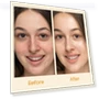 Thumbnail Gel Moisturizer for Face — Creams & Moisturizers, Honeyskin