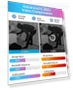 Превью Security Camera System with AI Human/Vehicle Detection — Security Cameras, ZOSI