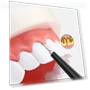 Thumbnail Oral Tooth Cleaning and Care Tool — Dental Hygiene Essentials