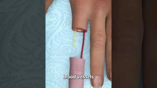 Can You Reattach a Severed Finger? 🤔